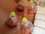 Slika 1